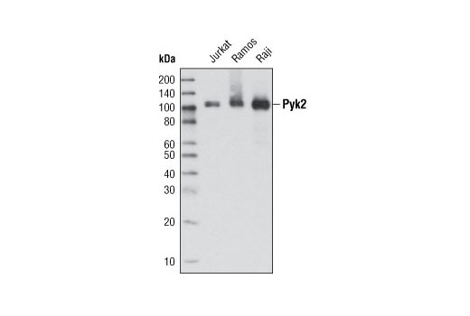 Western blot analysis of extracts from various cell lines using Pyk2 (5E2) Mouse mAb.