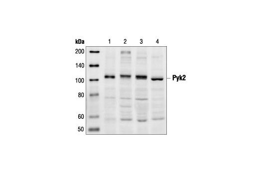 Western blot analysis of extracts from SKW6.4 (lane 1), Jurkat (lane 2), Namalwa (lane 3) and LS 102.9 (lane 4) cells using Pyk2 Antibody.