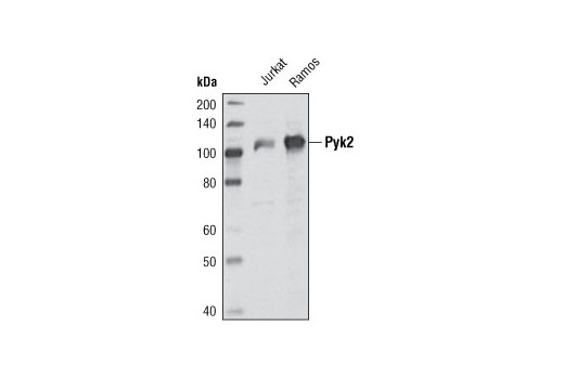 Western blot analysis of extracts from Jurkat and Ramos cells using Pyk2 (H364) Antibody.