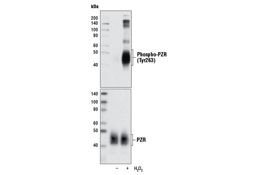 Western blot analysis of extracts from BAEC cells, untreated or H 2 O 2 -treated (0.3 mM for 30 min), using Phospho-PZR (Tyr263) Antibody (upper) and total PZR Antibody # 4157 (lower).