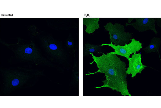 Confocal immunofluorescent analysis of BAE cells, untreated (left) or H 2 O 2 -treated (2 mM, 30 min; right) using Phospho-PZR (Tyr263) (D6A5) Rabbit mAb (green). Blue pseudocolor= DRAQ5 ® #4084 (fluorescent DNA dye).