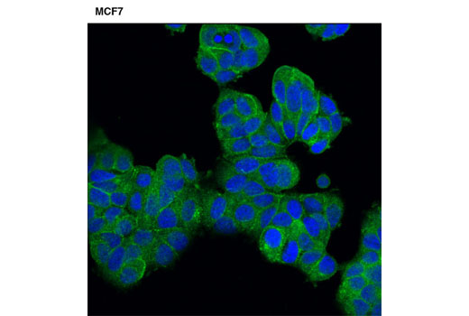Confocal immunofluorescent analysis of MCF7 cells using PZR (D17B10) XP ® Rabbit mAb (green). Blue pseudocolor = DRAQ5 ® #4084 (fluorescent DNA dye).