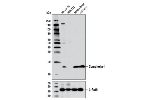 Western blot analysis of extracts from various cells lines and tissues using Complexin-1 Antibody (upper) or β-Actin (D6A8) Rabbit mAb #8457 (lower).