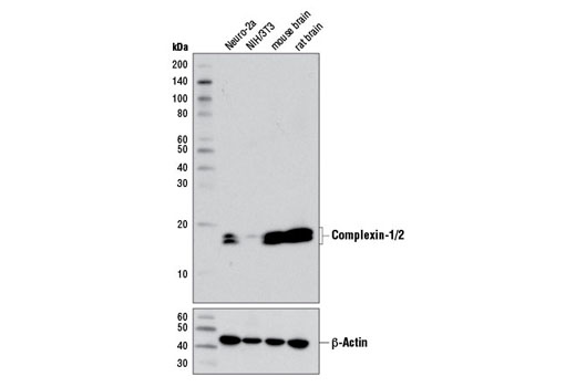 Western blot analysis of extracts from various cell lines and tissues using Complexin-1/2 Antibody (upper) or β-Actin (D6A8) Rabbit mAb #8457 (lower).