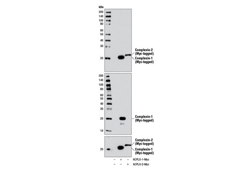 Western blot analysis of extracts from 293T cells, mock transfected (-) or transfected with a construct expressing Myc-tagged full-length human complexin-1 (hCPLX-1-Myc; +) or complexin-2 (hCPLX-2-Myc; +), using Complexin-1/2 Antibody (upper), Complexin-1 Antibody #13239 (middle) and Myc-Tag (71D10) Rabbit mAb #2278 (lower).