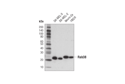 Western blot analysis of extracts from various cell lines using Rab38 (D2V9Z) Rabbit mAb.