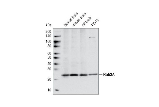 Western blot analysis of extracts from human brain, mouse brain, rat brain and PC-12 cells using Rab3A Antibody.