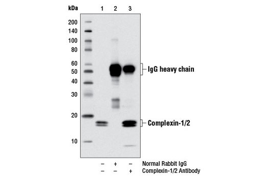 Immunoprecipitation of complexin-1 and complexin-2 from Neuro-2a cell extracts using Normal Rabbit IgG #2729 (lane 2) or Complexin-1/2 Antibody (lane 3). Lane 1 is 10% input. Western blot analysis was performed using Complexin-1/2 Antibody.