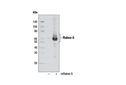 Western blot analysis of extracts from 293T cells, mock transfected (-) or transfected with a mouse Rabex-5 (variant 2) cDNA construct (+), using Rabex-5 (D21F12) Rabbit mAb.