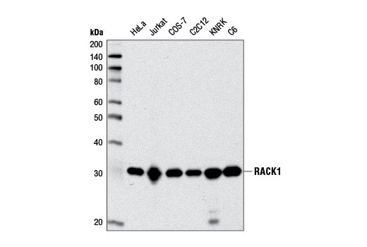 Western blot analysis of extracts from various cell types using RACK1 (D59D5) Rabbit mAb.