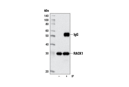 Immunoprecipitation of RACK1 from HeLa cell lysates using