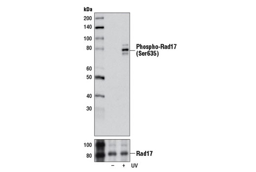 Western blot analysis of A549 cell extracts, untreated (-) or UV-treated (100 mJ, 18 hr recovery; +), using Phospho-Rad17 (Ser635) (D6K9P) Rabbit mAb (upper) or Rad17 (D3G6) Rabbit mAb #8561 (lower).