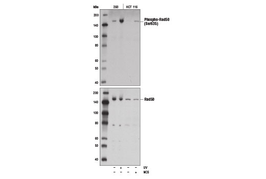 Western blotting analysis of extracts from 293 cells, untreated (-) or UV-treated (100 mJ, 2 hr; +) or HCT 116 cells, untreated (-) or neocarzinostatin-treated (NCS, 10μM, 1 hr; +) using Phospho-Rad50 (Ser635) Antibody (upper) or Rad50 Antibody #3427 (lower).