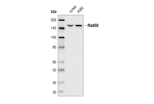 Western blot analysis of extracts from Jurkat and K562 cells, using RAD50 Antibody.