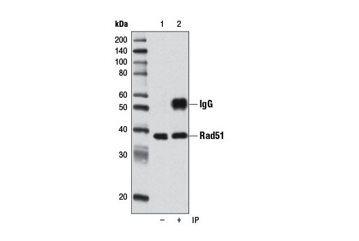 Immunoprecipitation of Rad51 from HeLa cell extracts using Rad51 (D4B10) Rabbit mAb (lane 2). Western blot detection was performed using the same antibody. Lane 1 is 10% input.