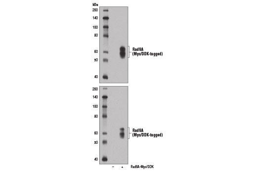 Western blot analysis of extracts from 293T cells, mock transfected (-) or transfected with a construct expressing Myc/DDK-tagged full-length human Rad9A (Rad9A-Myc/DDK; +) protein, using Rad9A (D2J4P) Rabbit mAb (upper) or Myc-Tag (71D10) Rabbit mAb #2278 (lower).