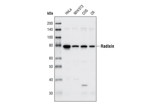 Western blot analysis of extracts from various cell types using Radixin (C4G7) Rabbit mAb.