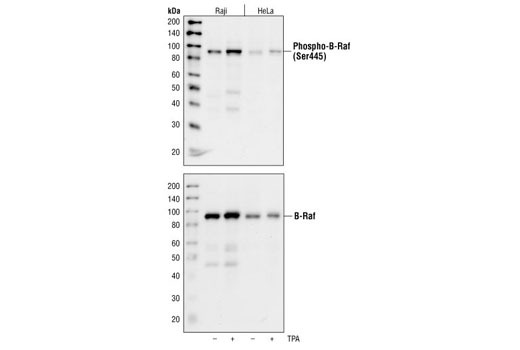 Western blot analysis of extracts from Raji and HeLa cells treated with TPA (200nM, 30 minutes) using Phospho-B-Raf (Ser445) Antibody (top) and total B-Raf Antibody (bottom).