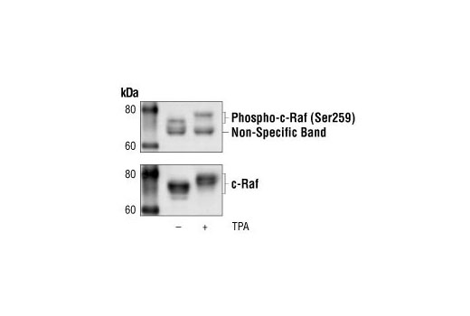 Western blot analysis of extracts from HeLa cells, untreated or TPA-treated, using Phospho-c-Raf (Ser259) Antibody (upper), or a total c-Raf antibody (lower).