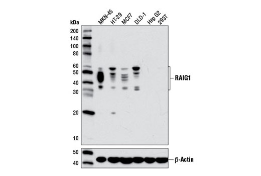 Western blot analysis of extracts from various cell lines using RAIG1 (D4S7D) XP ® Rabbit mAb (upper) or β-Actin (D6A8) Rabbit mAb #8547 (lower)