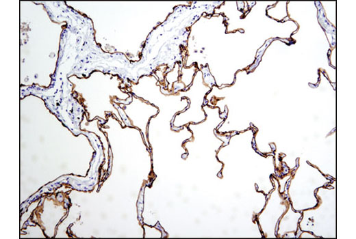 Immunohistochemical analysis of paraffin-embedded human normal lung using RAIG1 (D4S7D) XP ® Rabbit mAb.