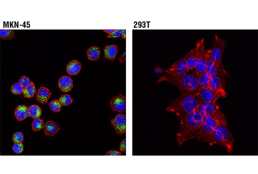 Confocal immunofluorescent analysis of MKN-45 (left) and 293T (right) cells using RAIG1 (D4S7D) XP ® Rabbit mAb (green). Actin filaments were labeled with DyLight® 554 Phalloidin #13054. Blue pseudocolor = DRAQ5 ® #4084 (fluorescent DNA dye).