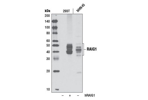 Western blot analysis of extracts from untransfected or human RAIG1-transfected 293T cells and untransfected MKN-45 cells using RAIG1 Antibody.