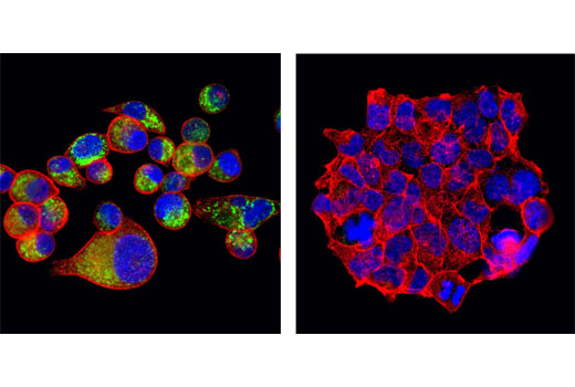 Confocal immunofluorescent analysis of MKN-45 (left) and 293 (right) cells using RAIG1 Antibody (green). Actin filaments have been labeled with DY-554 phalloidin. Blue pseudocolor = DRAQ5 ® #4084 (fluorescent DNA dye).