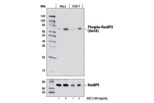 Western blot analysis of extracts from HeLa and COS-7 cells, serum-starved overnight and either left untreated or treated with hEGF #8916 (100 ng/ml), using Phospho-RanBP3 (Ser58) Antibody (upper) or RanBP3 Rabbit mAb (lower).