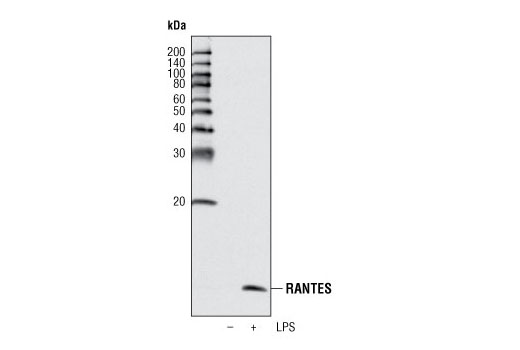 Western blot analysis of extracts from differentiated THP-1 cells, untreated or treated overnight with LPS, using RANTES (R40) Antibody.