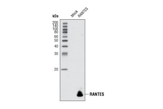 Western blot analysis of HeLa cells, mock transfected or transfected with human RANTES construct, using RANTES (R40) Antibody.
