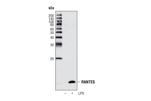 Western blot analysis of extracts from differentiated THP-1 cells, untreated or treated overnight with LPS, using RANTES (P20) Antibody.