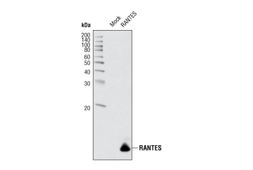 Western blot analysis of HeLa cells, mock transfected or transfected with human RANTES construct, using RANTES (P20) Antibody.