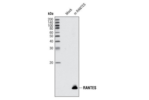 Western blot analysis of HeLa cells, mock transfected or transfected with mouse RANTES, using RANTES Antibody (Rodent Specific).