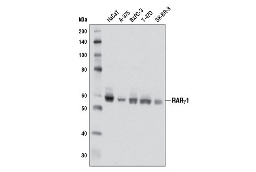 Western blot analysis of extracts from various cell lines using RARγ1 (D3A4) XP ® Rabbit mAb.