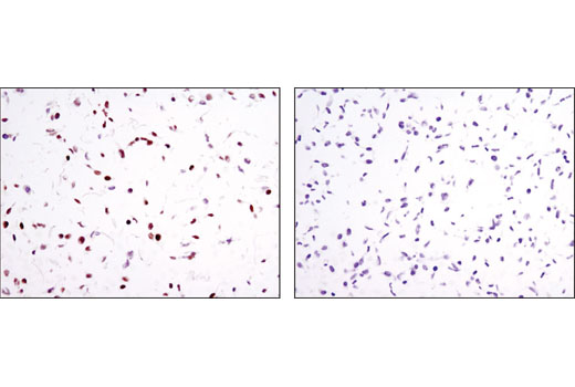 Immunohistochemical analysis of paraffin-embedded cell pellets, HaCaT (positive, left) and Hep3B (negative, right), using RARγ1 (D3A4) XP ® Rabbit mAb.
