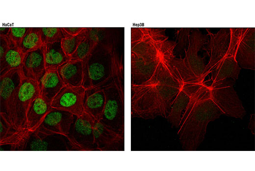 Confocal immunofluorescent analysis of HaCaT cells (positive, left) and Hep3B cells (negative, right) using RARγ1 (D3A4) XP ® Rabbit mAb (green). Actin filaments were labeled with DY-554 phalloidin (red).