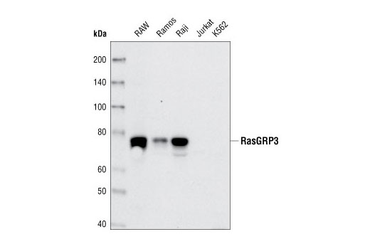Western blot analysis of extracts from various cell types using RasGRP3 (C33A3) Rabbit mAb.