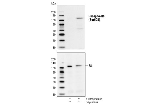 Western blot analysis of extracts from HeLa cells treated with lambda Phosphatase NEB #P0753 (10,000 units/ml, 1 h) or calyculin A #9902 (100 nM, 10 min) using Phospho-Rb (Ser608) Antibody (upper) or Rb (4H1) Mouse mAb #9309 (lower).