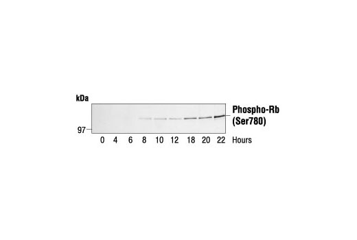 Western blot analysis of extracts from human fibroblasts synchronized by serum deprivation, using Phospho-Rb (Ser780) Antibody. Cells were synchronized for 24 hours then released by addition of serum and harvested at the times indicated. Cell cycle progression was verified by cyclin analysis and FACS. (Provided by John Boylan, Dupont/Merck, Delaware.)