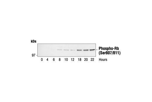Western blot analysis of extracts from human fibroblasts synchronized by serum deprivation, using Phospho-Rb (Ser807/811) Antibody. Cells were synchronized for 24 hours then released by addition of serum and harvested at the times indicated. Cell cycle progression was verified by cyclin analysis and FACS. (Provided by John Boylan, Dupont/Merck, Delaware.)