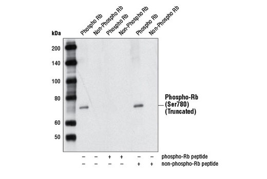 Western blot analysis of recombinant truncated Rb, without or with Rb blocking peptide, using Phospho-Rb (Ser780) (C84F6) Rabbit mAb.
