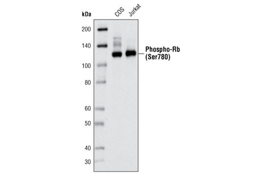 Western blot analysis of extracts from COS and Jurkat cells using Phospho-Rb (Ser780) (C84F6) Rabbit mAb.