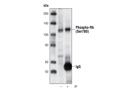 Immunoprecipitation of phospho-Rb (Ser780) from Jurkat cell lysates using Phospho-Rb (Ser780) (C84F6) Rabbit mAb followed by western blot using the same antibody. Lane 1 is 5% input.