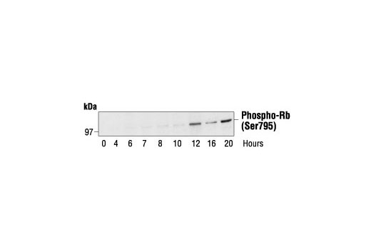 Western blot analysis of extracts from human fibroblasts synchronized by serum deprivation, using Phospho-Rb (Ser795) Antibody. Cells were synchronized for 24 hours, then released by addition of serum and harvested at the times indicated. Cell cycle progression was verified by cyclin analysis and FACS. (Provided by John Boylan, Dupont/Merck, Delaware.)