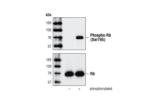 Western blot analysis of Rb Control Protein #9303, using Phospho-Rb (Ser795) Antibody (upper) or Rb (4H1) mAb #9309 (lower).