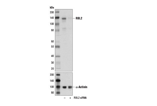Western blot analysis of extracts from 293 cells, transfected with 100 nM SignalSilence ® Control siRNA (Unconjugated) #6568 (-) or SignalSilence ® RBL2 siRNA I # 14712 (+), using RBL2 (D9T7M) Rabbit mAb (upper) and α-Actinin (D6F6) XP ® Rabbit mAb #6487 (lower). The RBL2 (D9T7M) Rabbit mAb confirms silencing of RBL2 expression, while the α-Actinin (D6F6) XP ® Rabbit mAb is used as a loading control.