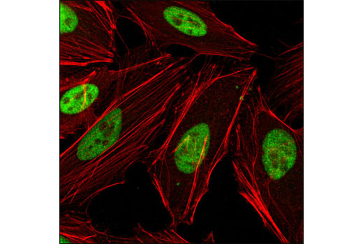Confocal immunofluorescent analysis of HeLa cells using RBAP46 (V415) Antibody (green). Actin filaments were labeled with DY-554 phalloidin (red).