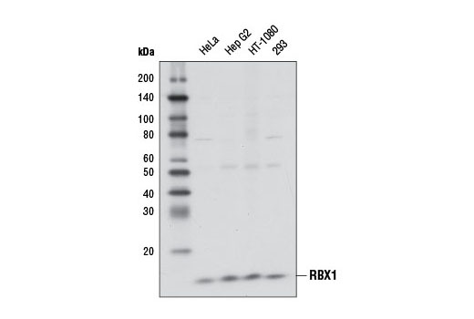 Western blot analysis of extracts from various cell lines using RBX1 (D3J5I) Rabbit mAb.