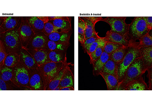 Confocal immunofluorescent analysis of MCF7 cells, untreated (left) or treated with Brefeldin A #9972 (5 μg/ml, 1 hr; right), using RCAS1 (D2B6N) XP ® Rabbit mAb (green). Actin filaments were labeled with DY-554 phalloidin (red). Blue pseudocolor = DRAQ5 ® #4084 (fluorescent DNA dye).